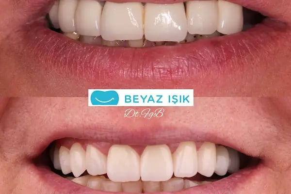 Beyaz Işık Ağız ve Diş Sağlığı Merkezi - Resim 6