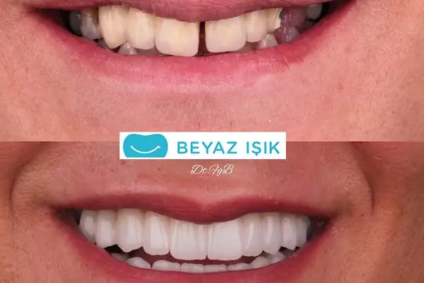 Beyaz Işık Ağız ve Diş Sağlığı Merkezi - Resim 13