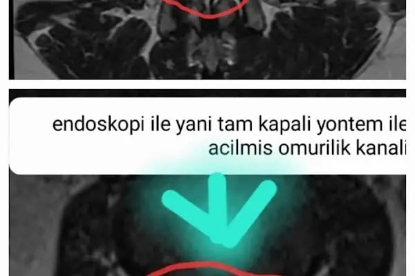 Prof. Dr. Hayati Aygün - Ortopedi ve Travmatoloji/Omurga Cerrahisi - Resim 13