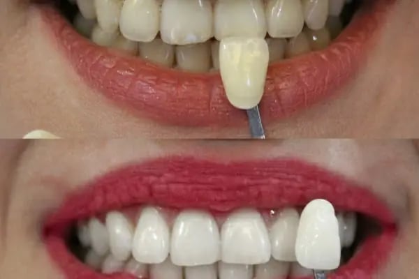 Özel Pearly Ağız ve Diş Sağlığı Polikliniği - Resim 12