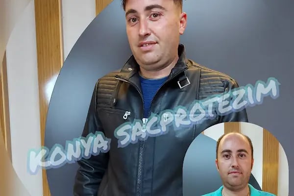 Nafiz Keskin Protez Saç Kliniği - Resim 18