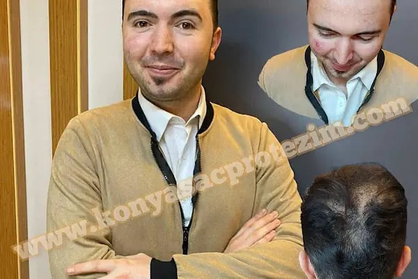 Nafiz Keskin Protez Saç Kliniği - Resim 1