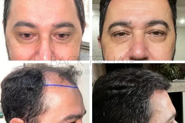 Back to Hair İstanbul - Resim 12