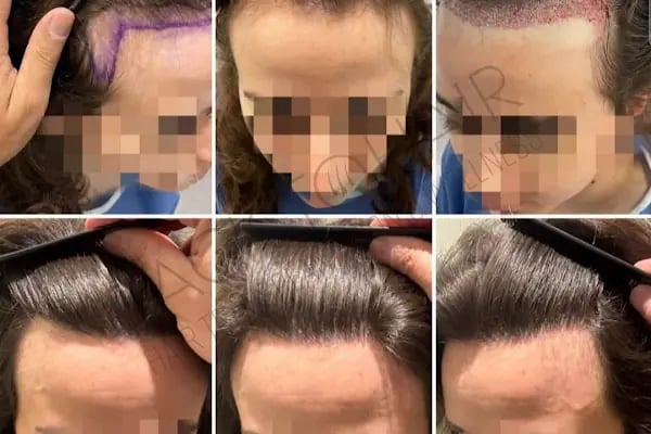 Back to Hair İstanbul - Resim 10