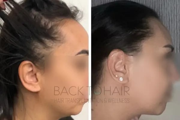 Back to Hair İstanbul - Resim 19