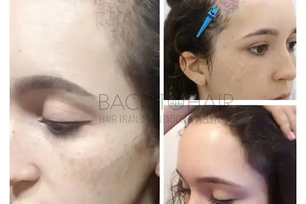 Back to Hair İstanbul - Resim 13