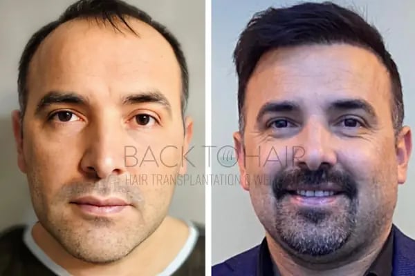 Back to Hair İstanbul - Resim 4