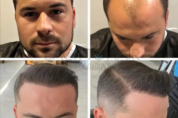 Back to Hair İstanbul - Resim 17
