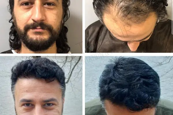 Back to Hair İstanbul - Resim 14
