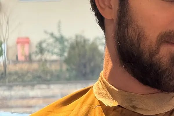 Kadir Alkan Gaziantep - Resim 13