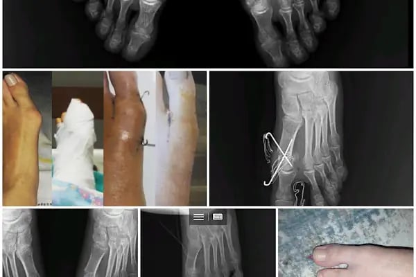 Operatör Doktor Tarık Alphan Ortopedi ve Travmatoloji - Resim 20