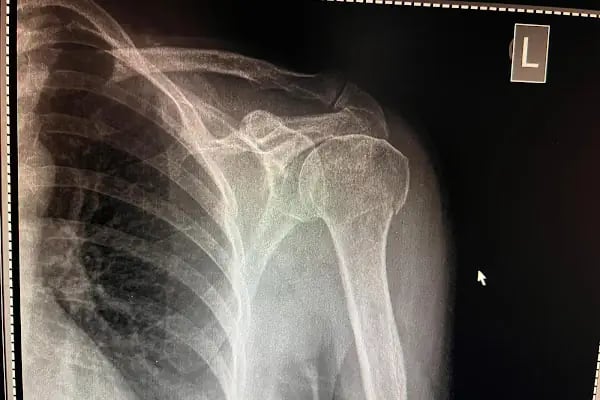 Operatör Doktor Tarık Alphan Ortopedi ve Travmatoloji - Resim 19