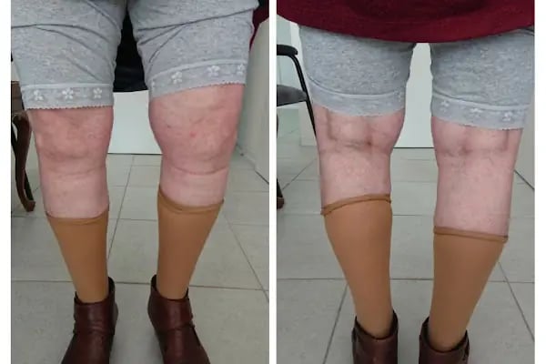 Operatör Doktor Tarık Alphan Ortopedi ve Travmatoloji - Resim 11