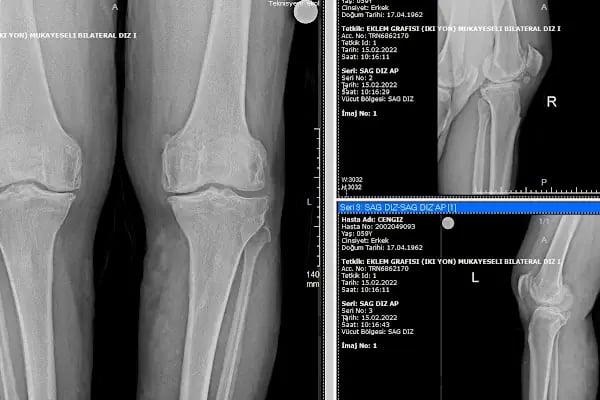 Operatör Doktor Tarık Alphan Ortopedi ve Travmatoloji - Resim 18