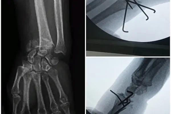 Operatör Doktor Tarık Alphan Ortopedi ve Travmatoloji - Resim 15