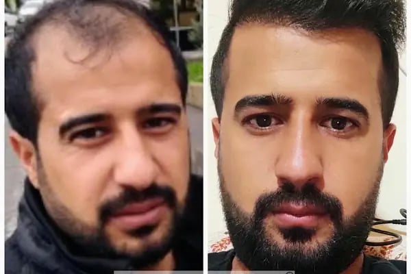 Hair Ajans Saç Ekim Merkezi - Resim 11