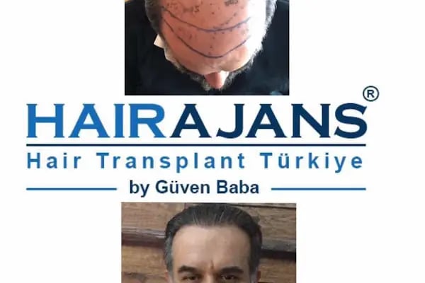 Hair Ajans Saç Ekim Merkezi - Resim 8