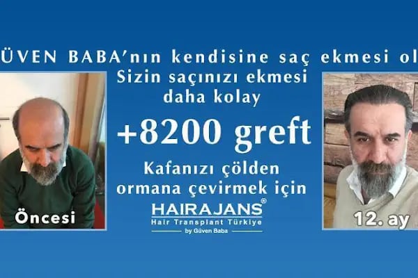 Hair Ajans Saç Ekim Merkezi - Resim 15