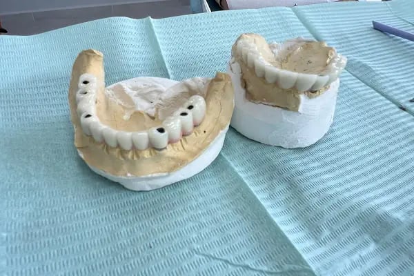Özel Başiskele Ağız ve Diş Sağlığı Polikliniği - Resim 11
