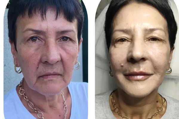 DR. NEVİN MERT CLİNİC - Resim 8