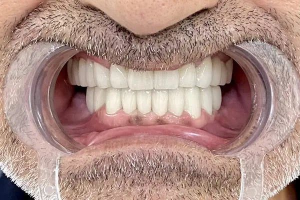 Alihan Akçam Ağız ve Diş Sağlığı Kliniği | Zirkonyum Kaplama, İmplant, Gülüş Tasarımı | Narlıdere Diş Hekimi - Resim 2