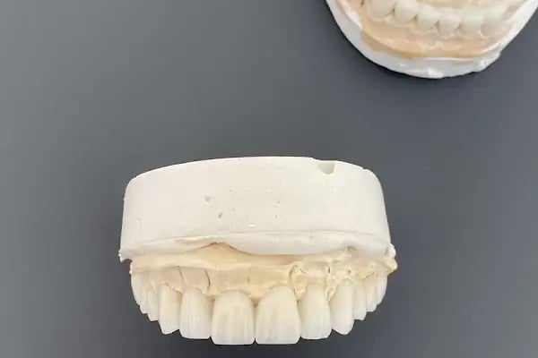 Alihan Akçam Ağız ve Diş Sağlığı Kliniği | Zirkonyum Kaplama, İmplant, Gülüş Tasarımı | Narlıdere Diş Hekimi - Resim 19