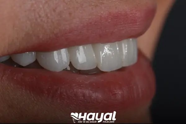 Hayal Ağız ve Diş Sağlığı Polikliniği - Resim 11