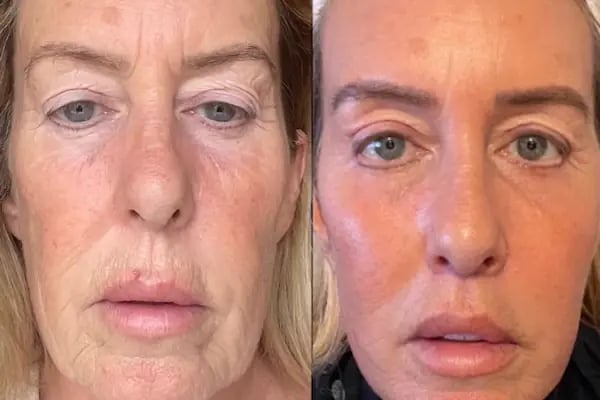Doç. Dr. Fikret Eren Estetik, Plastik, Rekonstrüktif Cerrahi Kliniği Fikret Eren - Resim 11