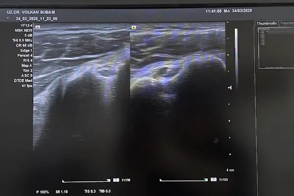 Uz.Dr.Volkan SUBAŞI-Fizik Tedavi Rehabilitasyon ve Tamamlayıcı tıp - Resim 20