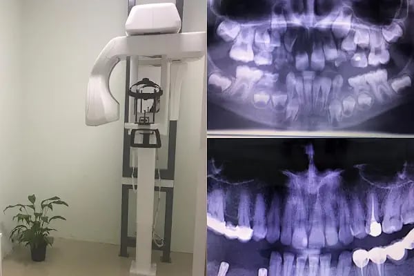 Karacabey Ağız ve Diş Sağlığı Polikliniği - Resim 4