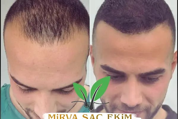 Hifa'M Beauty Center - Resim 3