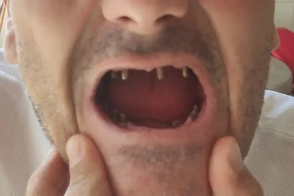 TunaDent Ağız ve Diş Sağlığı Polikliniği - Resim 6