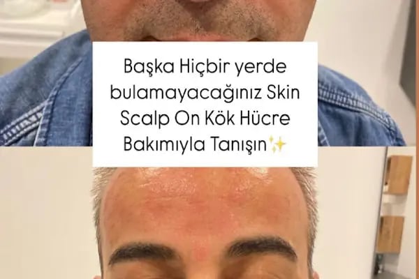 S Clinic Adana - Saç Çoğaltma, Saç Bakım ve Güzellik Merkezi - Resim 1