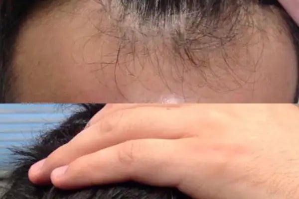 S Clinic Adana - Saç Çoğaltma, Saç Bakım ve Güzellik Merkezi - Resim 6