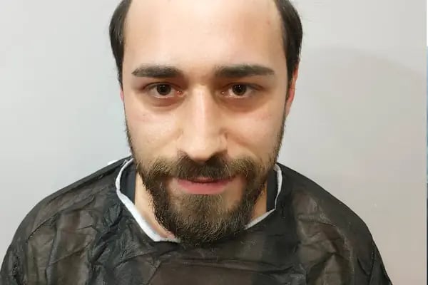 Saç Ekim Merkezi - Resim 11