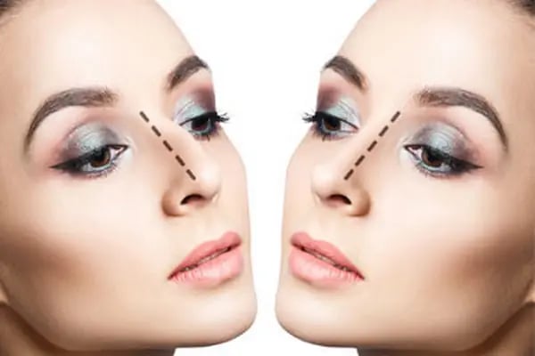 Op.Dr. Mehmet Doğan- Estetik, Plastik ve Rekonstrüktif Cerrahi Kliniği - Resim 7