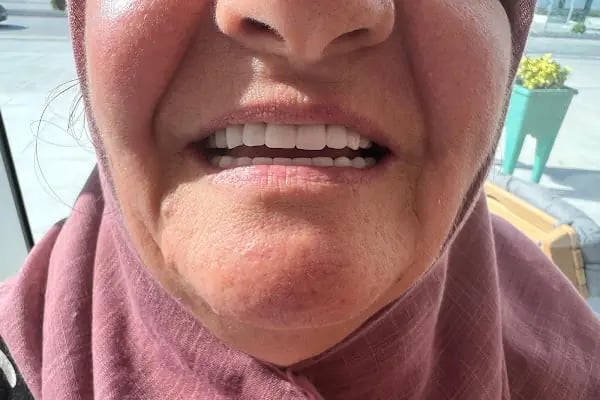 İncipol Ağız ve Diş Sağlığı Polikliniği - Resim 15