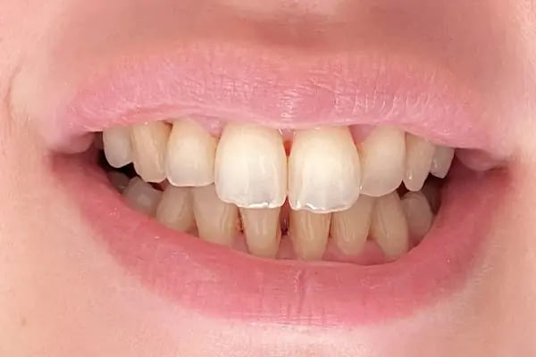 İncipol Ağız ve Diş Sağlığı Polikliniği - Resim 1