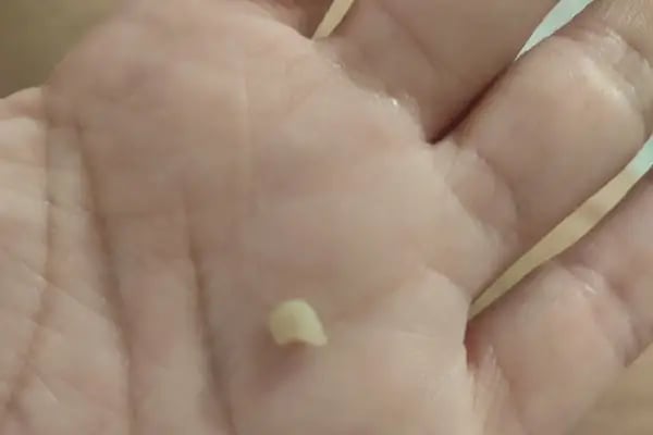 White Dental Clinic Ağız ve Diş Sağlığı Polikliniği - Resim 12