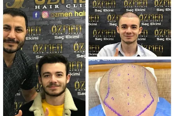 Özmen Saç Ekim , Estetik Ve Güzellik Merkezi - Resim 7