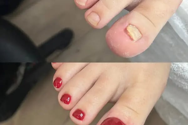 MediEste Bağlıca Güzellik, Epilasyon ve Ayak Sağlığı Merkezi - Resim 18