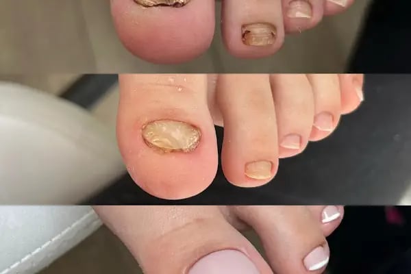 MediEste Bağlıca Güzellik, Epilasyon ve Ayak Sağlığı Merkezi - Resim 3