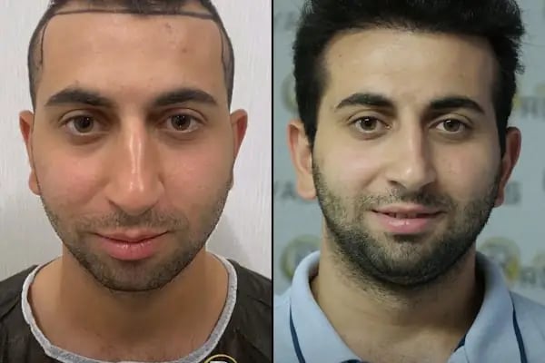 viaTurka İstanbul Medical Aesthetics, Dental &amp; Hair Transplant - Resim 11