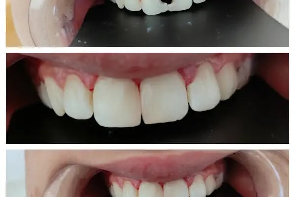 Diş Hekimi Ümmü Topal - Resim 8