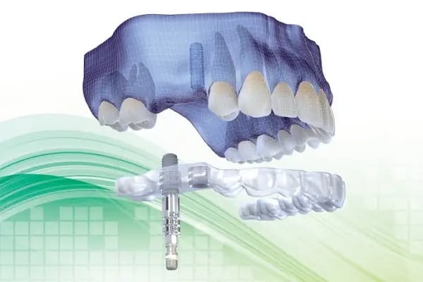 Özel ASSAF Ağız ve Diş Sağlığı Polikliniği - Diş implant - Emax lamina - Resim 6