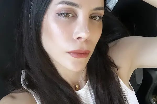 Burun Estetiği - Resim 4