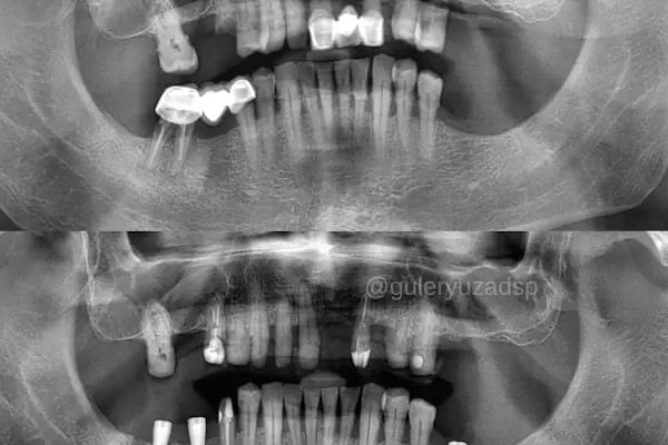 Özel Bağcılar Güleryüz Diş Kliniği - Resim 8