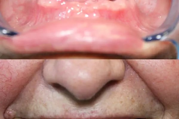 Özel Bağcılar Güleryüz Diş Kliniği - Resim 16