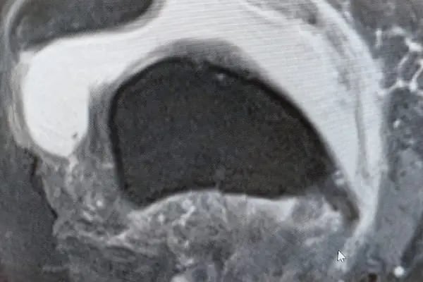Bursa Ortopedi Doktoru Doç.Dr.Erkam Kömürcü, Ortopedi ve Travmatoloji Kliniği - Resim 12