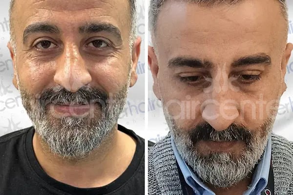Haircenter Saç Ekim Merkezi - Resim 1